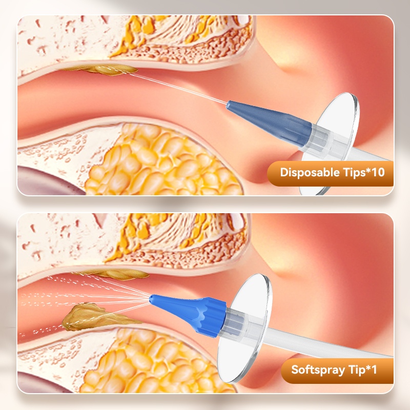 Ear Wax Removal Manual Ear Irr - đánh giá và giá Smart Garden Watering System